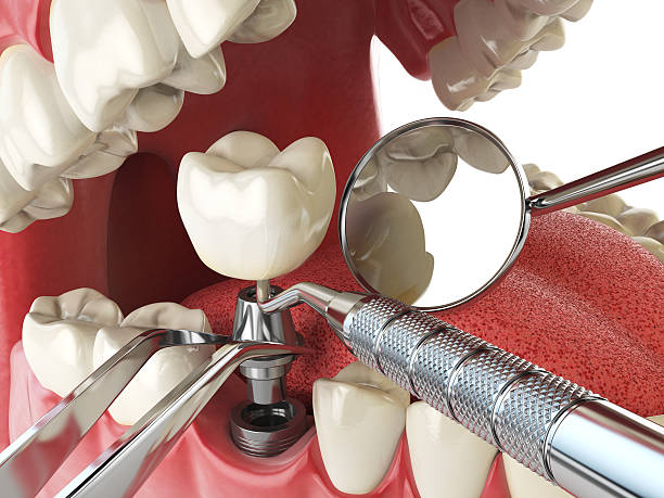 Best Broken or Cracked Tooth Emergency Dentist in Edwardsville, PA